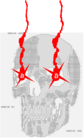 skull